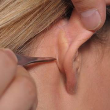 İple Kepçe Kulak Ameliyatı